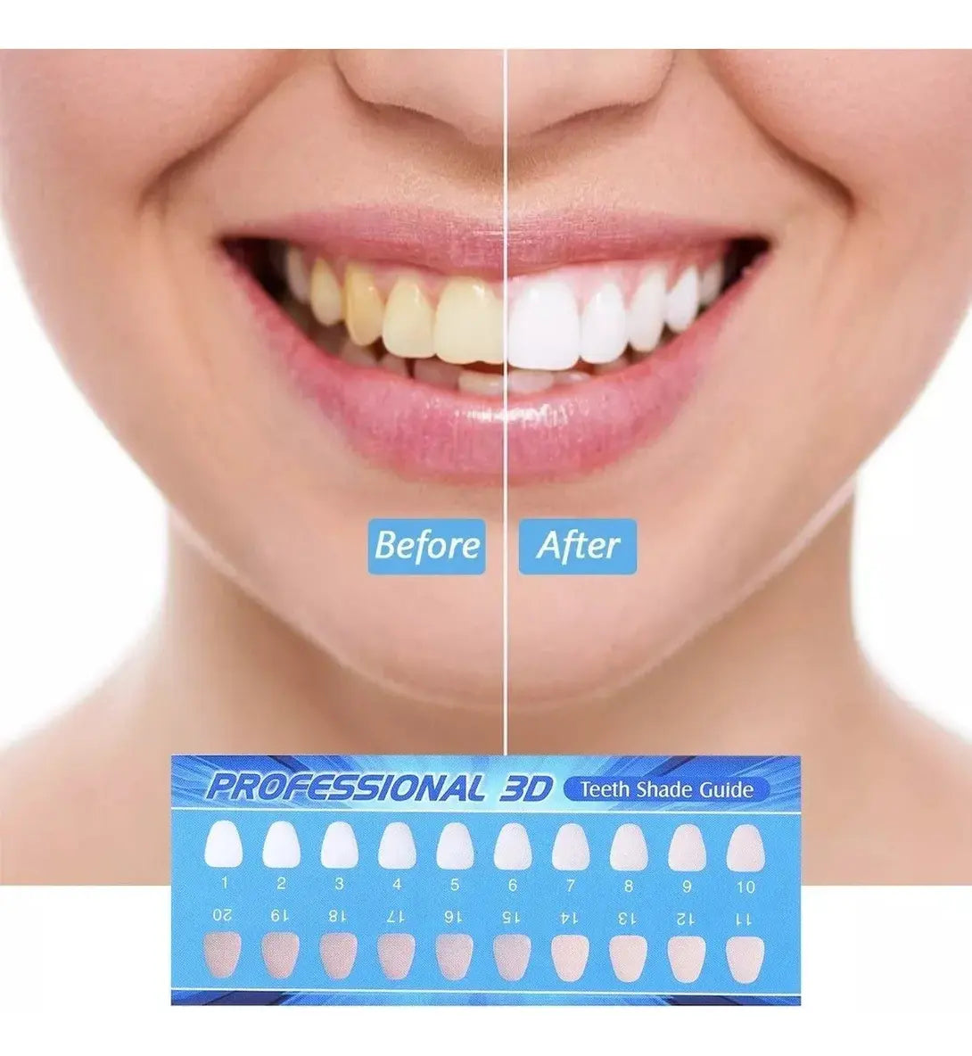 BLANQUEADOR DENTAL