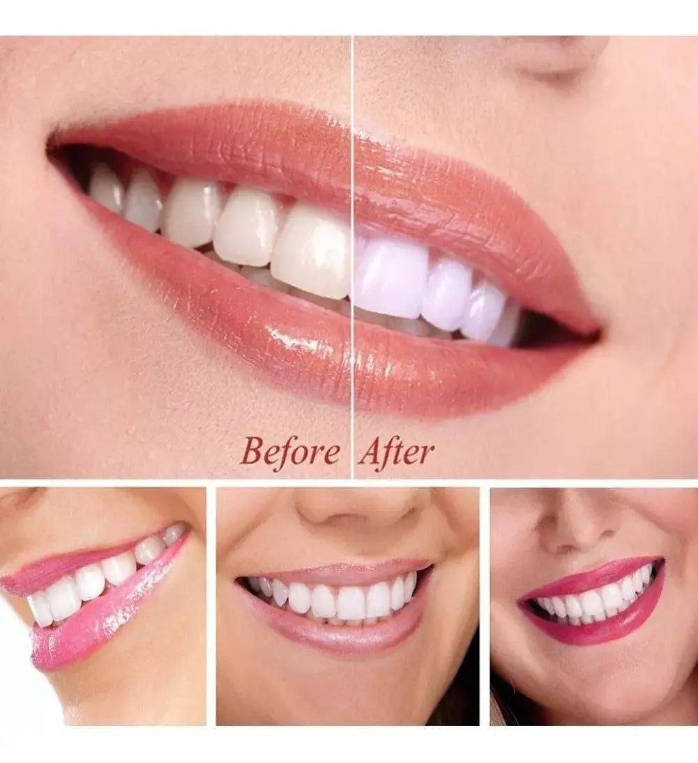 BLANQUEADOR DENTAL